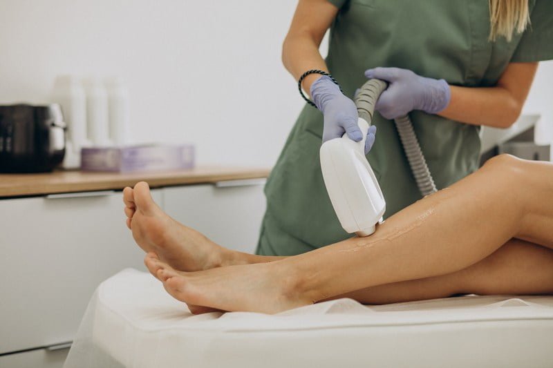 Laser epilation, hair removal therapy tattoo tktx sin dolor anestesico anestesicas